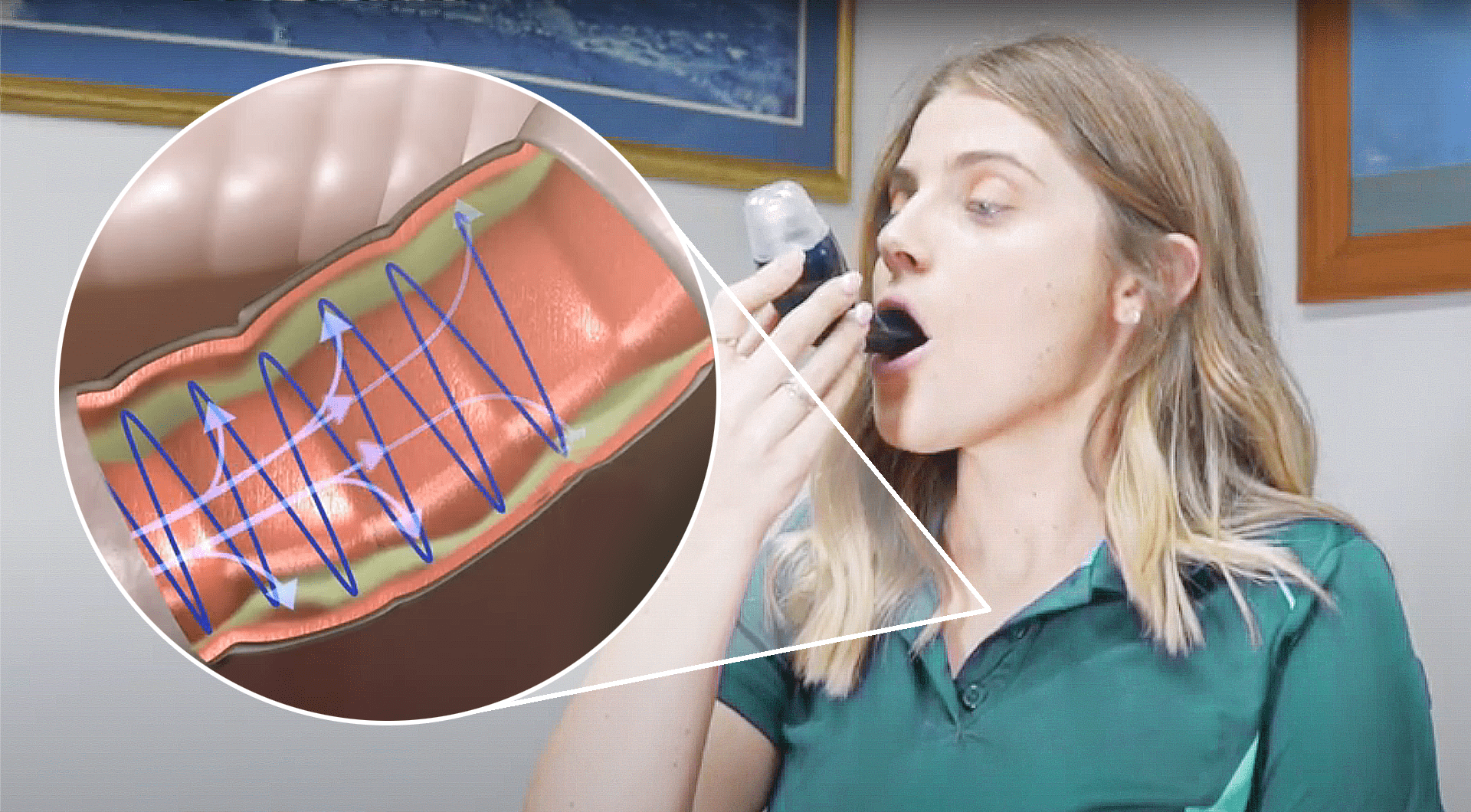 AirPhysio Review