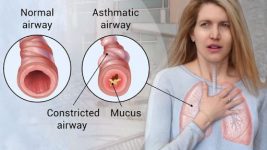 Can Asthma Be Cured By Yoga?