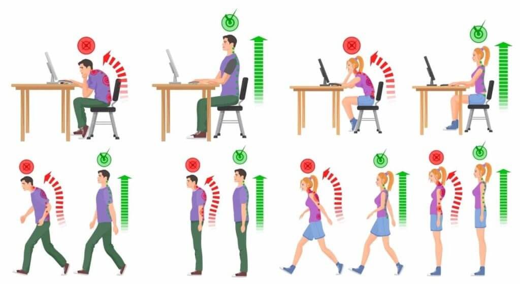 What Causes Bad Posture?