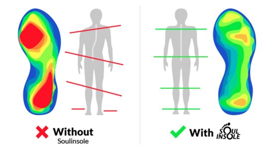 Difference before and after using Soul Insole