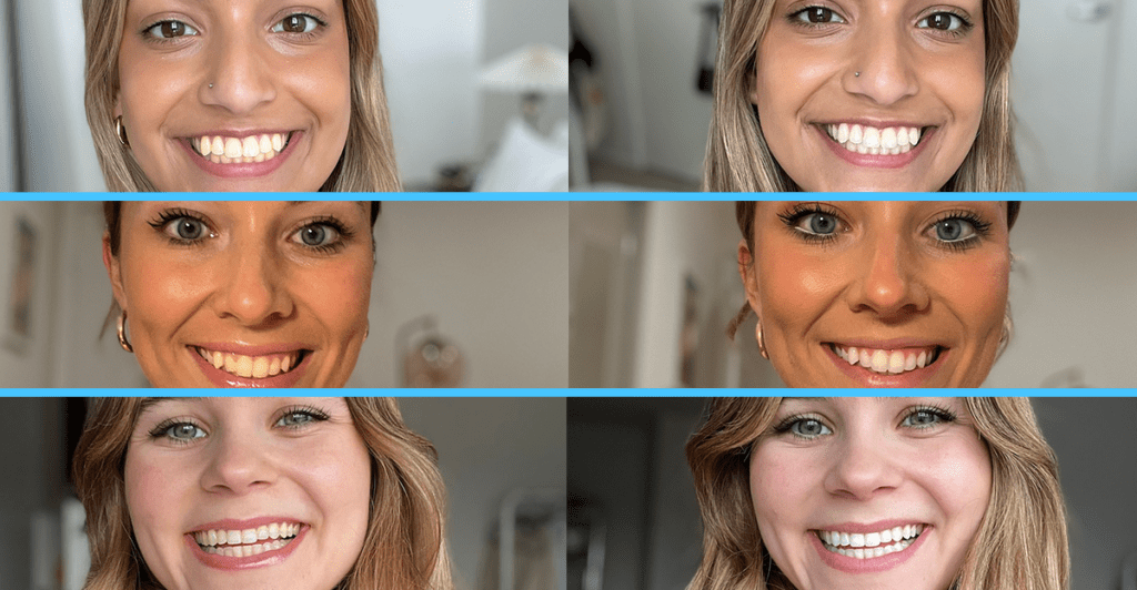Laughland Review: Does This Custom Teeth Whitening Kit Actually Work? 3 Laughland